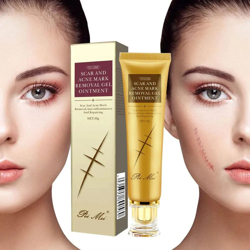 Gel Removedor de cicatriz - Mozinova
