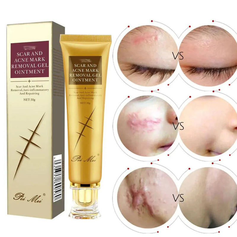 Gel Removedor de cicatriz - Mozinova