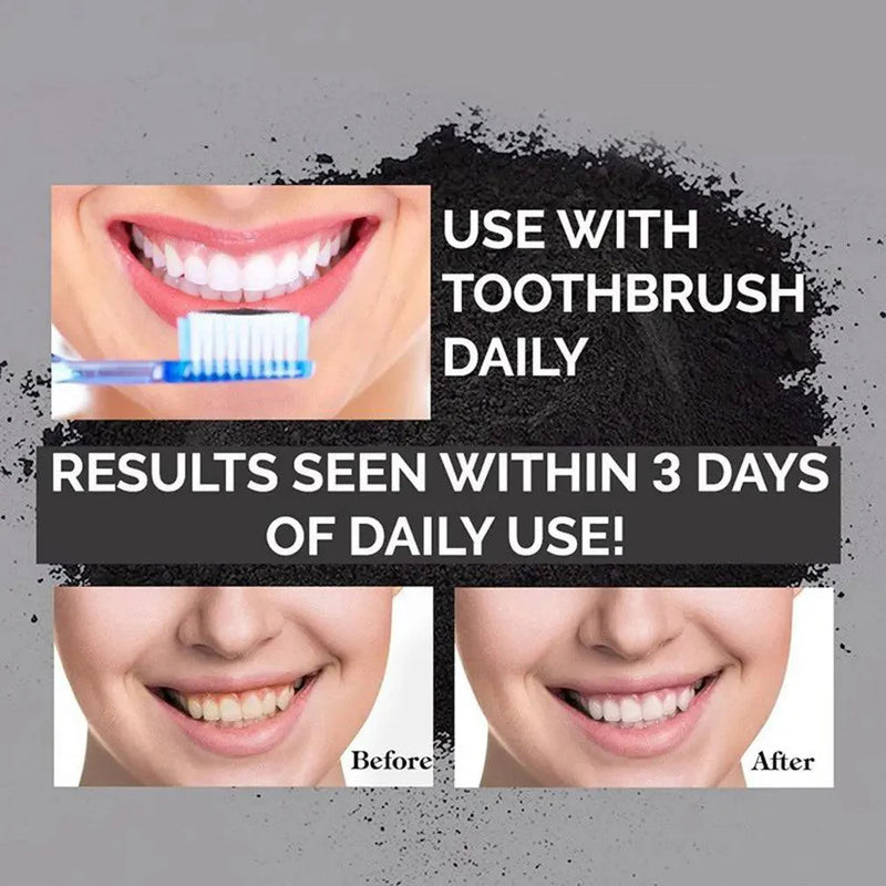 Clareador dental - Mozinova